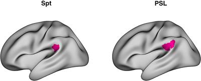 Multivariate FMRI Signatures of Learning in a Hebb Repetition Paradigm With Tone Sequences